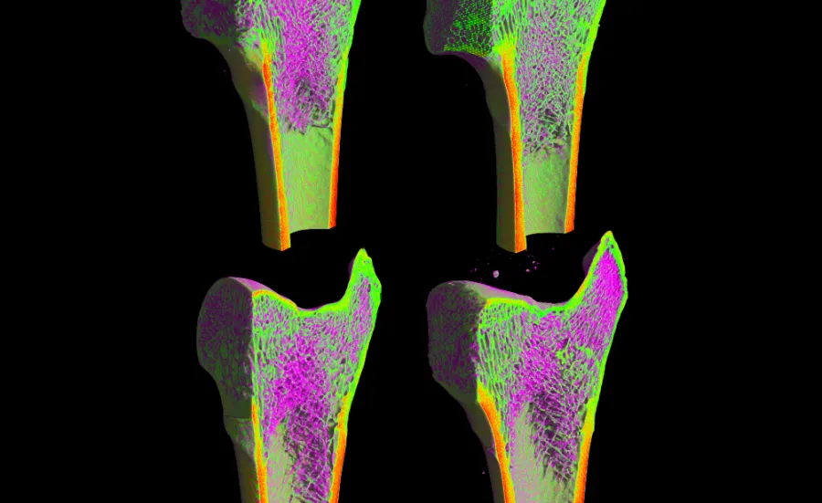 4 Stained femur cross sections