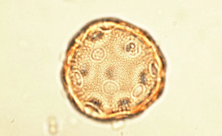 Pollen grain seen under light microscope