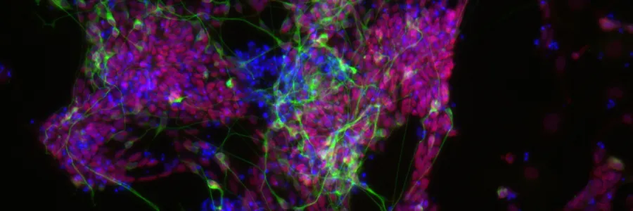 E14 Nuclei Tubb3 Sox1 10 x 0, 10-100microns