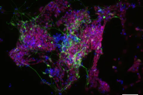 E14 Nuclei Tubb3 Sox1 10 x 0, 10-100microns