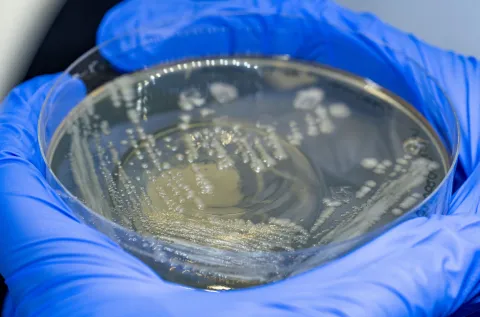 2 gloved hands holding a petri dish with bacteia growing 