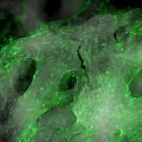 Microscope image of fluorescent cells on trabeculae