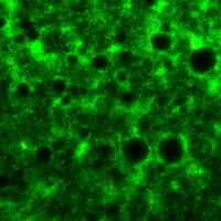 A pseudomonas aeruginosa biofilm, featuring dark circles pockmarking the surface. 